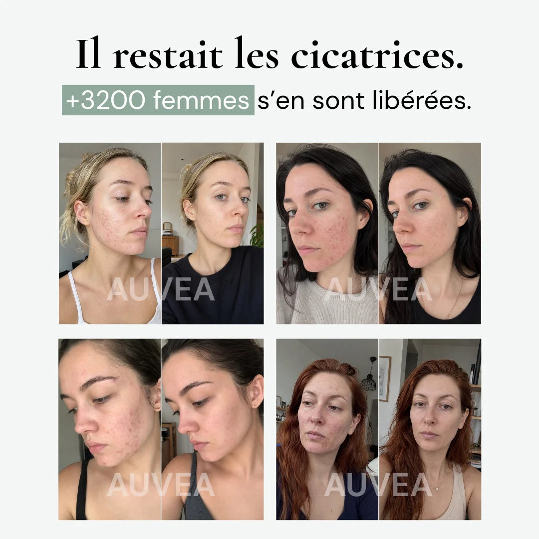 Soin Silicone Marques & Cicatrices