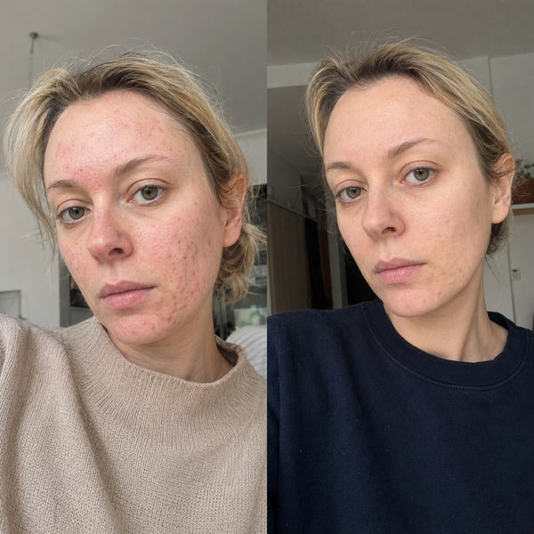 Aurélie, 27