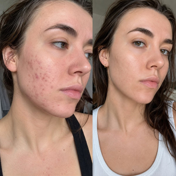 Anaïs, 26