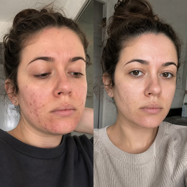 Chloé, 25